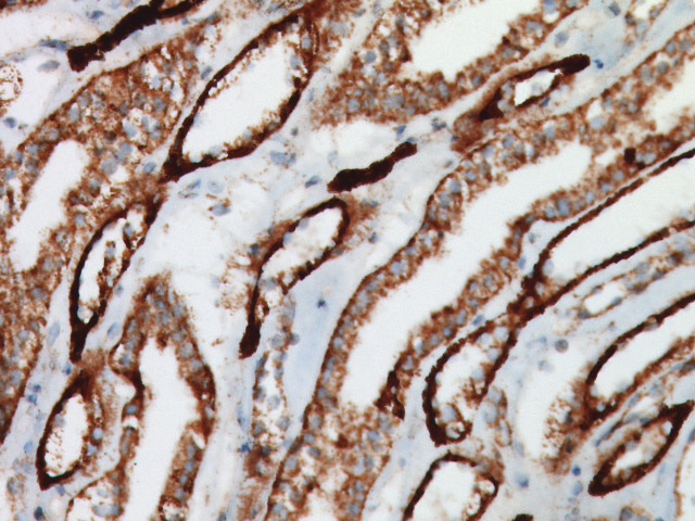 ABC kit on kidney (negative control) showing endogenous biotin staining following a 2-step, 50 minute procedure to remove endogenous biotin