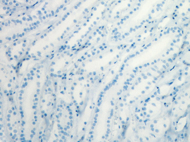 Kidney (negative control) stained with MACH 1 showing no endogenous biotin staining. No avidin-biotin blocking procedure necessary