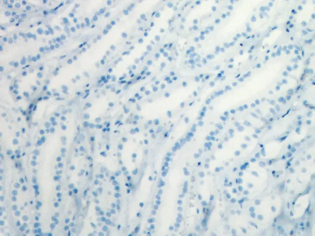 Kidney (negative control) stained with MACH 1 showing no endogenous biotin staining. No avidin-biotin blocking procedure necessary