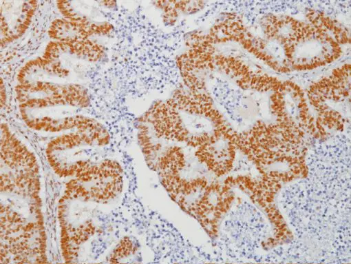 MLH-1 Antibody - Biocare Medical