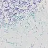 Normal cerebullum stained with Neurofilament antibody