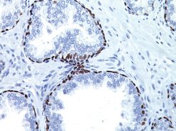 Prostate tissue stained with p63 antibody