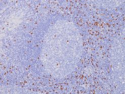 Tonsil stained with CD8 rabbit antibody