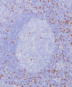 Tonsil stained with CD8 rabbit antibody