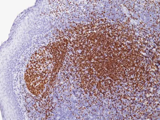Tonsil stained with PAX-5 antibody