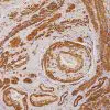 Blood vessels stained with Smooth Muscle Actin antibody (SMA)